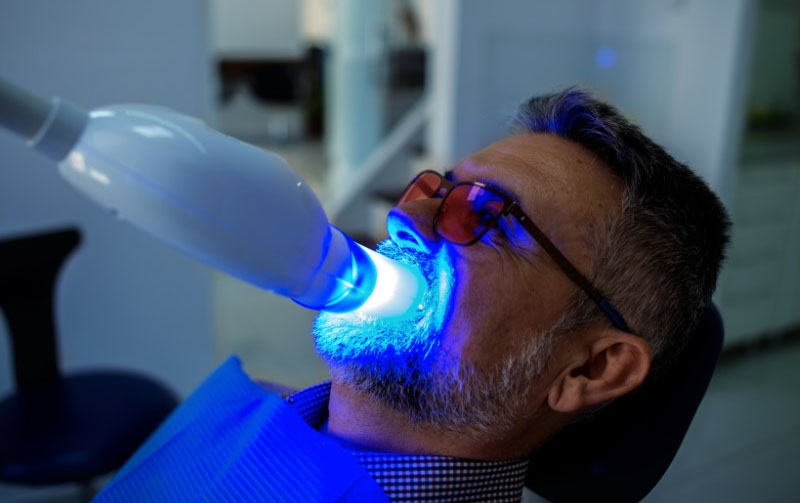Whitening